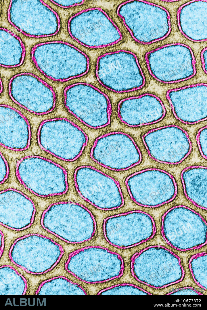 Transmission electron micrograph of the intestinal microvilli of a cat. The cross-section of each microvillus (in blue) is bounded by two dense lines of similar thickness (in black) separated by a lighter intermediate zone (in pink). Not all cell membranes exhibit his degree of symmetry. In some, the outer dense line is thinner than the inner.