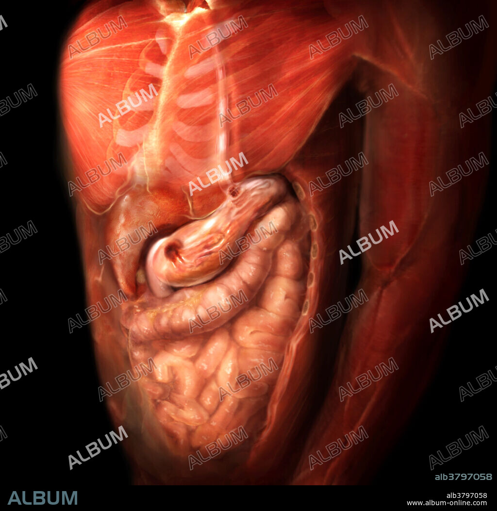 Lateral oblique view of a male torso featuring digestive organs. The digestive system is comprised of an alimentary canal and accessory organs; together they break down complex food into simple structures the body can use, absorb the nutrients into the blood stream, and eliminate waste. Food passes from the esophagus to the stomach through the cardiac sphincter, which prevents chyme, the thick semifluid mass of partly digested food, from returning to the esophagus. After chemical and mechanical digestion in the stomach, the chyme moves to the first part of the small intestine (the duodenum) through the pyloric sphincter, which controls the rate of stomach emptying.