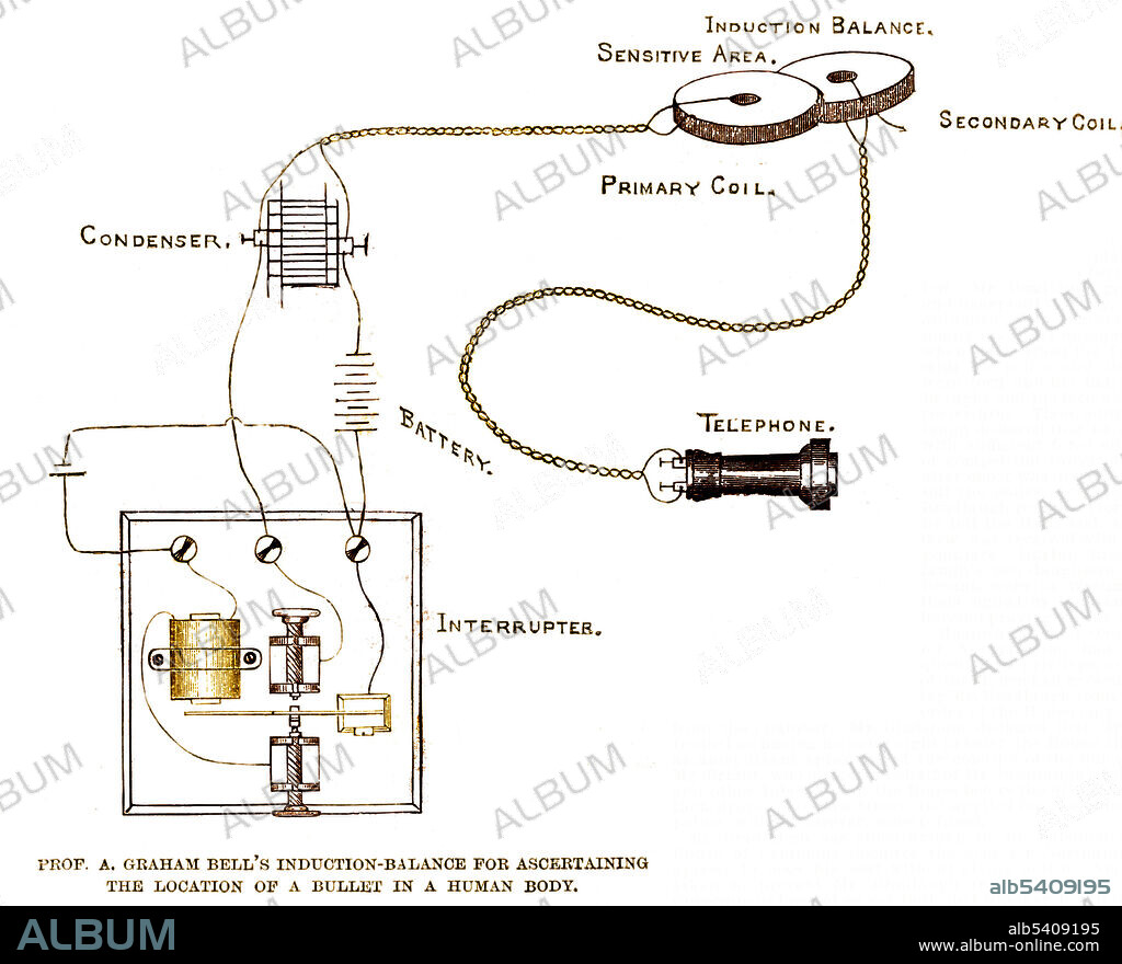 Professor Alexander Graham Bell's induction-balance for ascertaining the location of a bullet in a human body from a sketch by William A. Skinkle. Alexander Graham Bell (1847-1922) was a Scottish-American speech therapist and inventor of the telephone. He is also credited with developing one of the early versions of a metal detector in 1881. The device was quickly put together in an attempt to find the bullet in the body of U.S. President James Garfield. According to some accounts, the metal detector worked flawlessly in tests but did not find the bullet partly because the metal bed frame on which the President was lying disturbed the instrument. The president's surgeons, ignored Bell's requests to move the president to a bed not fitted with metal springs. Alternatively, although Bell had detected a slight sound on his first test, the bullet may have been lodged too deeply to be detected by the crude apparatus.