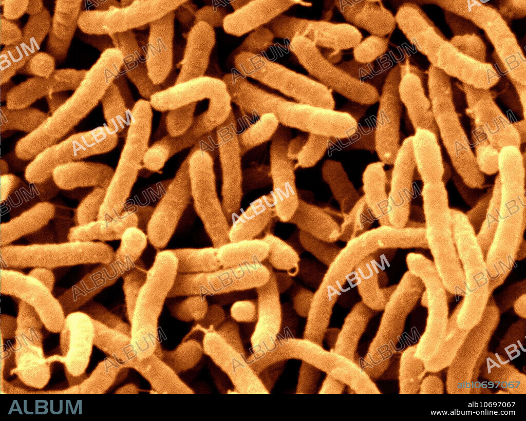 Colour enhanced scanning electron microscope of arcobacter septicus. Arcobacter bacteria live in the soil, sludge, faeces, stagnant water, sewage and other natural environments . Raw and undercooked meat (beef, pork, lamb), raw unpasteurized milk, untreated water, and shellfish have been implicated in the transmission of Arcobacter spp. They are now recognized as important human and animal pathogens which have been found to cause reproductive problems in pigs, abnormalities in rainbow trout, diarrhoea in animals and humans, even rare but severe cases of bacteremia (presence of bacteria in the blood). Their optimal temperature is 25 to 30 C so the relatively high body temperature of chickens (41 C) protects them from having their intestines colonized with Arcobacter. Some time ago, Arcobacter were called aerotolerant Campylobacter . Arcobacter is a member of the Epsilobacteria group, which also includes Campylobacter and Helicobacter spp. It.
