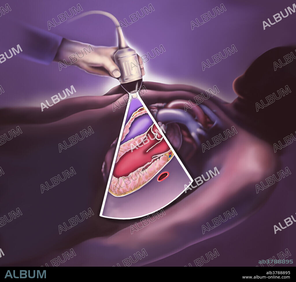 Medical illustration showing a hand holding an ultrasound machine