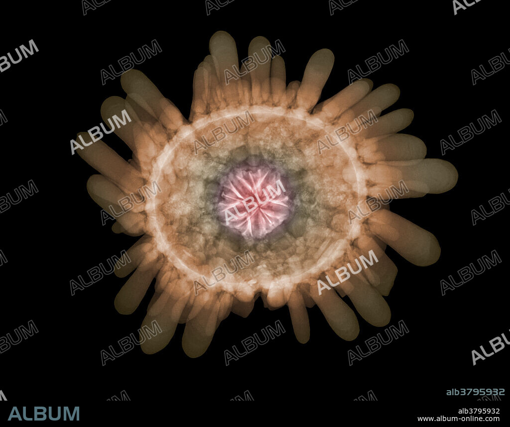 An Xray of the shingle urchin or helmet urchin (Colobocentrotus atratus). This species is common on the islands of Hawaii where it is also known as kaupali . It is found on wave swept rocks in the intertidal zone.
