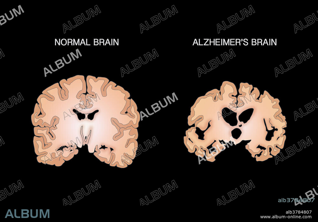 超貴重CD DNA「Scatter the brain」 超貴重CD DNA「Scatter the brain」 超貴重CD DNA「Scatter the