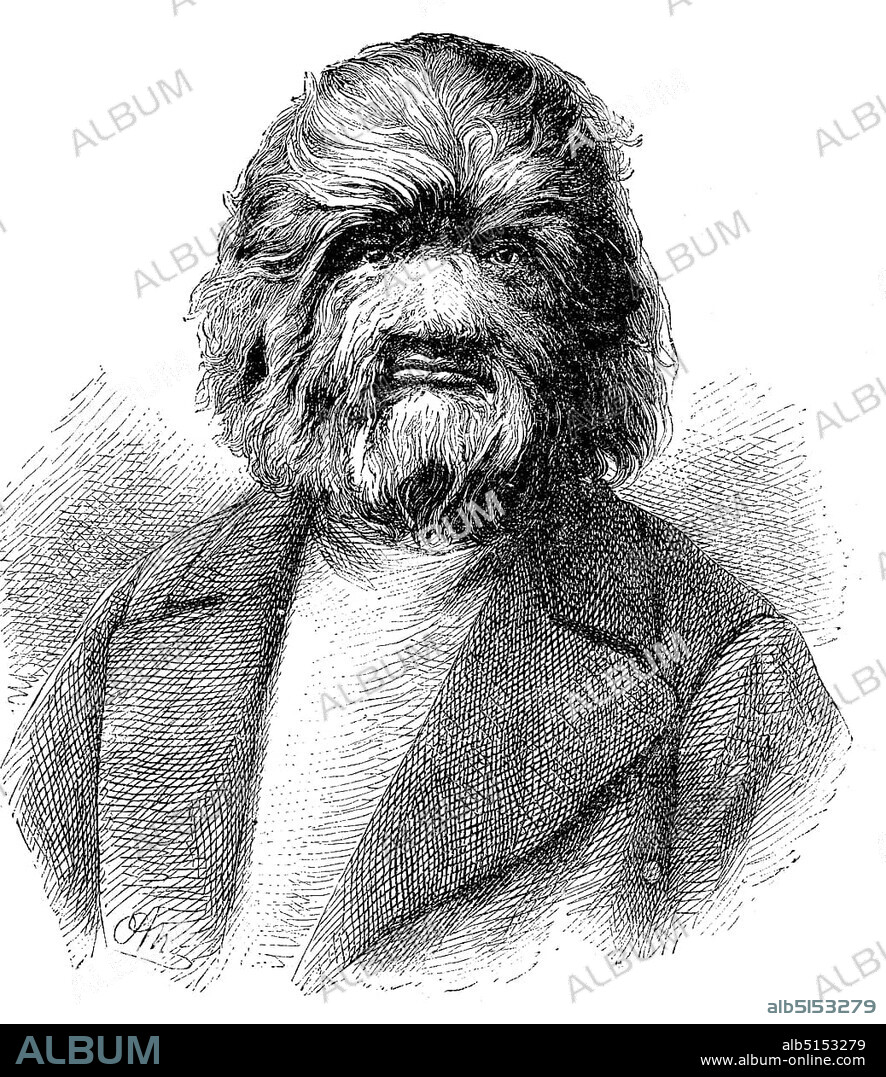 Dog-Faced Man, Fedor Adrianovich Jeftichew, Fyodor Yevtishchev, born 1868, died 1904, better known as Jo-Jo the Dog-Faced Boy, Dog-Faced Man, Russia