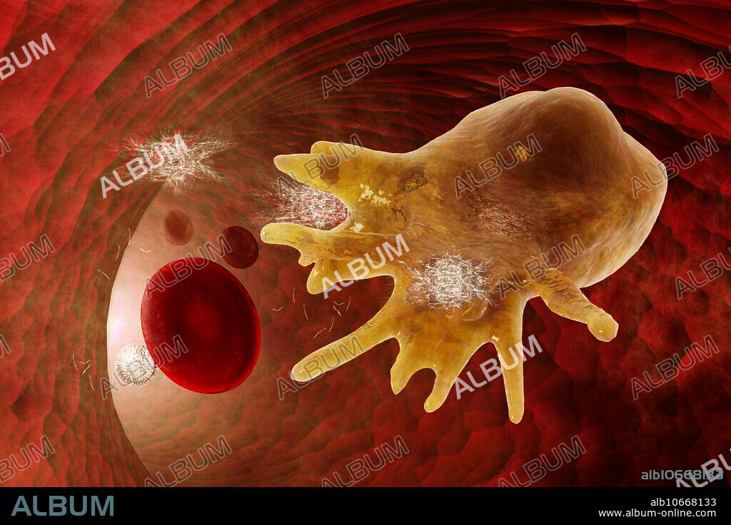 Illustration showing a macrophage cleaning away amyloid proteins in a blood vessel. Researchers are working on a vaccine to combat Alzheimer's disease. The vaccine activates large numbers of macrophages which clear away the damaging build-up of waxy amyloid proteins in the brain's vascular system.