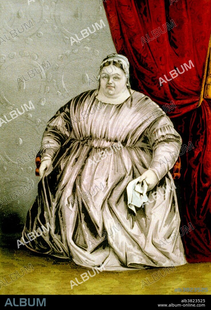 Entitled: "Miss Susan Barton: the mammoth lady, as exhibited at Barnum's American Museum, weight 576 pounds." Ancient Greek medicine recognizes obesity as a medical disorder, and records that the Ancient Egyptians saw it in the same way. Hippocrates wrote that "Corpulence is not only a disease itself, but the harbinger of others". For most of human history mankind struggled with food scarcity. Obesity has thus historically been viewed as a sign of wealth and prosperity. It was common among high officials in Europe in the Middle Ages and the Renaissance as well as in Ancient East Asian civilizations. Many cultures throughout history have viewed obesity as the result of a character flaw. During Christian times the food was viewed as a gateway to the sins of sloth and lust. In modern Western culture, excess weight is often regarded as unattractive, and obesity is commonly associated with various negative stereotypes. People of all ages can face social stigmatization, and may be targeted by bullies or shunned by their peers. Obesity is a medical condition in which excess body fat has accumulated to the extent that it may have a negative effect on health.