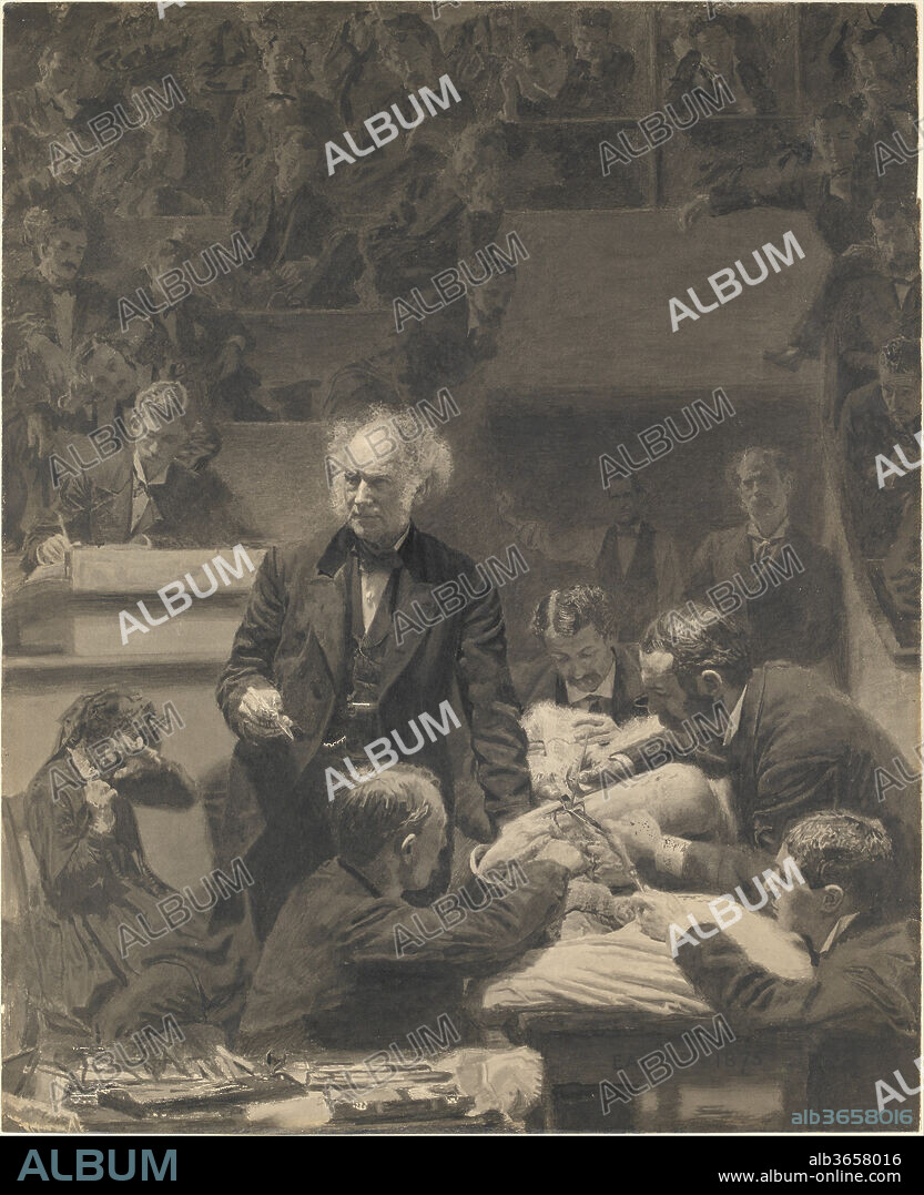 Gross Clinic. Artist: Thomas Eakins (American, Philadelphia, Pennsylvania 1844-1916 Philadelphia, Pennsylvania). Dimensions: 23 3/4 x 19 1/4 in. (60.3 x 48.9 cm). Date: 1875-76.