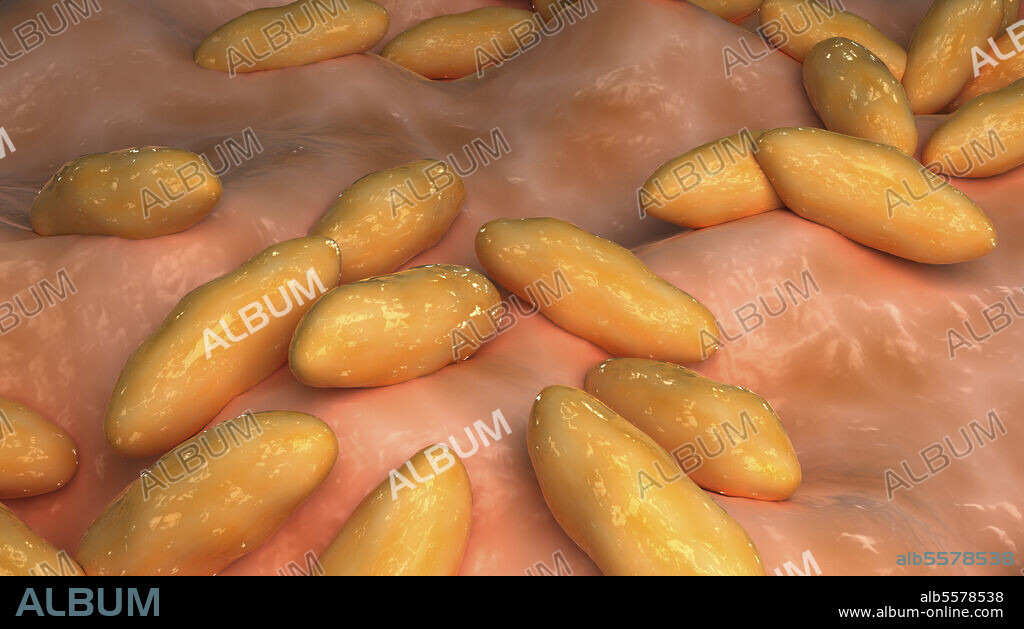 Conceptual biomedical illustration of brucellosis, also known as Malta fever.