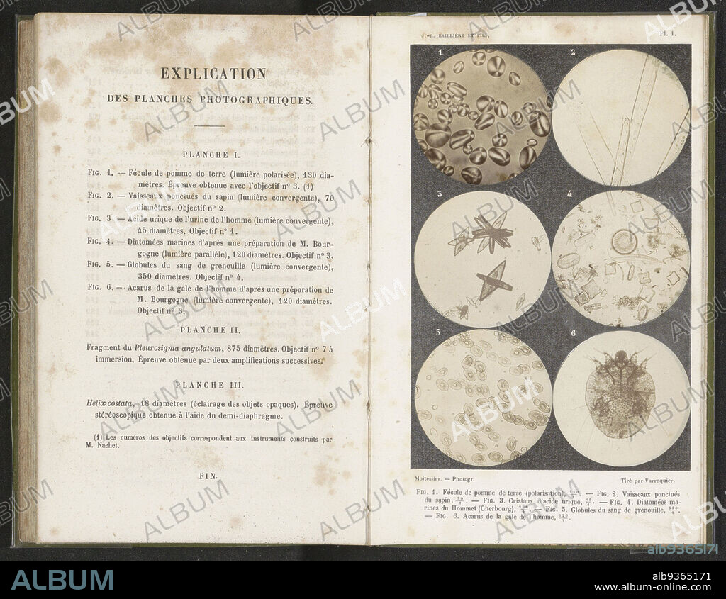 Six micro shots of cells, Numbers 1 to 6: potato starch, pine needle, uric acid crystals, diatoms, blood cells of a frog, mite of human scab., Albert Moitessier (mentioned on object), Armand Varroquier (mentioned on object), c. 1856 - in or before 1866, photographic support, albumen print, height 175 mm × width 110 mm.