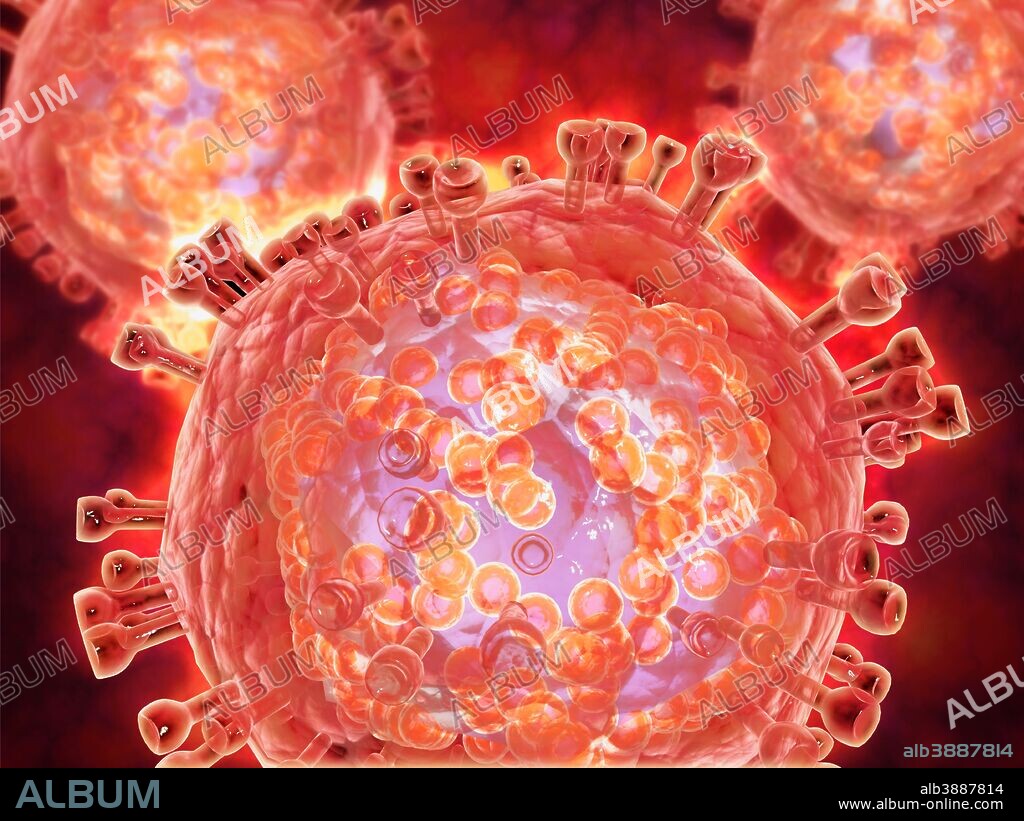 Cluster of HIV virus. HIV is the human immunodeficiency virus that can lead to acquired immune deficiency syndrom, or AIDS.