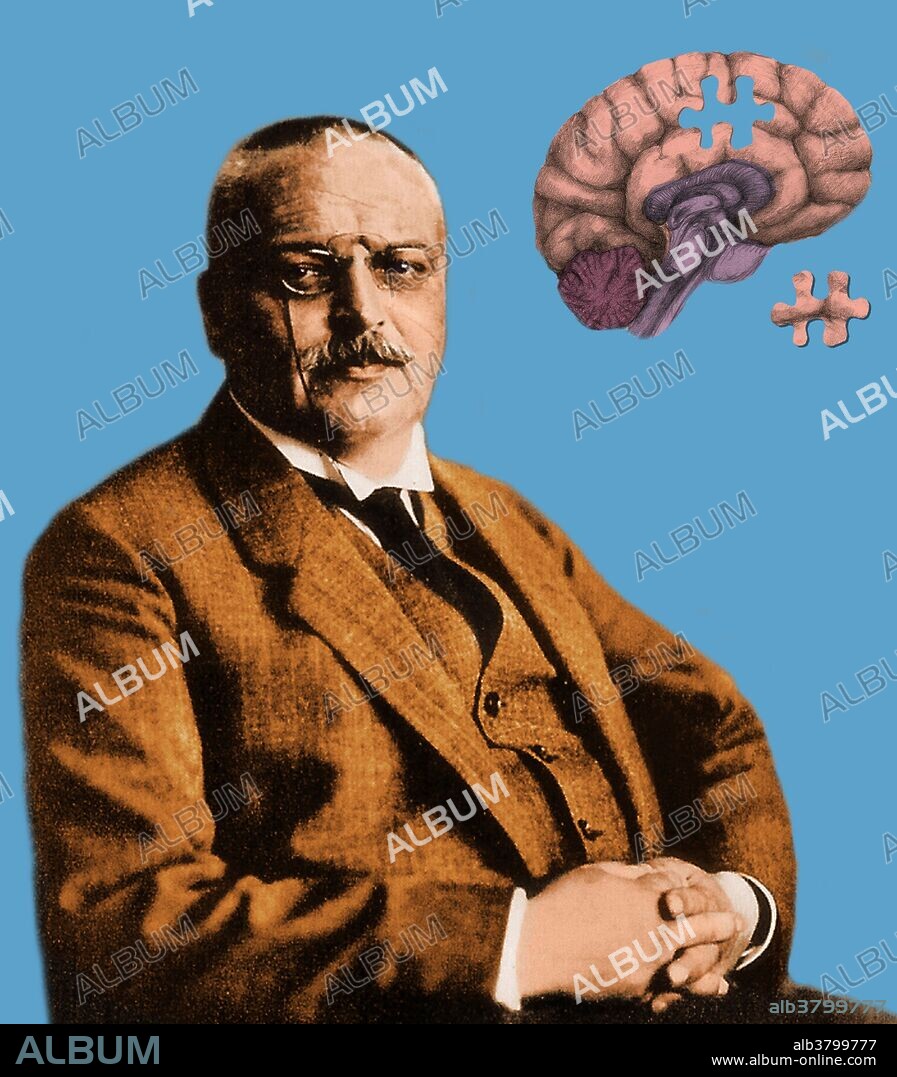 Alois Alzheimer (1864-1915). In 1906, German psychiatrist and neuropathologist Alois Alzheimer made a complete clinical and pathological description of presenile dementia, which came to be known as Alzheimer's disease, a progressive condition in which nerve cells in the brain degenerate. Inset image showing a brain with a piece missing, a conceptual illustration of Alzheimer's disease.