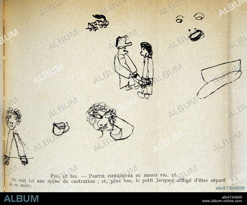 Fig. 18 bis.Partie inférieure du dessin fig. 18. On voit ici une scène de castration ; et, plus bas, le petit Jacques affligé d'être séparé de sa mère. "Ayant constaté que l'unique moyen d'expression de Jacques était le dessin, je l'ai employé pour le traitement. Dès la première séance je l'ai fait dessiner. Je donnais à ces dessins des interprétations que Jacques approuvait ou désapprouvait par des signes de tête. C'est ainsi que je réussis à l'aider à exprimer ses conflits inconscients. Je lui demandais s'il avait un chagrin, lorsqu'il répondait affirmativement à ma question, je lui disais : « Dessine-le moi ». "Sophie Morgenstern, « Un Cas de Mutisme Psychogène », Revue Française de Psychanalyse, Première année, T. I, n° 3, Éd. G. Doin et Cie, 1927. 'Le mutisme psychogène infantile n'a, jusqu'à présent, été décrit nulle part. Dans le présent travail, je vais tâcher de montrer par quel conflit psychologique un enfant de 9 ans et demi s'est trouvé emprisonné dans un mutisme qui a duré presque deux ans et dont le caractère spécial m'a permis de faire une étude psychanalytique assez étendue. C'est grâce à M. Heuyer que j'ai eu la possibilité de suivre de près et de soigner ce cas si intéressant et, jusqu'à présent, du moins à ma connaissance, unique.' Credit Jean VIGNE/KHARBINE TAPABOR.