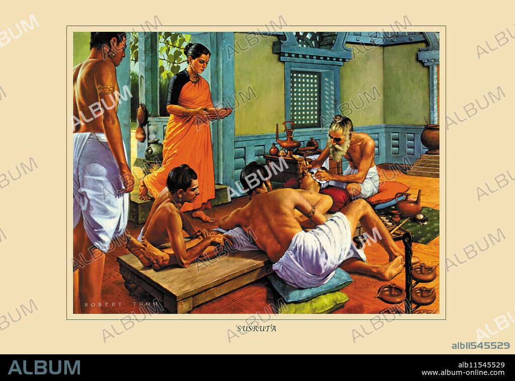 ROBERT THOM. Sushruta, or Susruta ("well heard") was an ancient Indian physician, known as the main author of the treatise The Compendium of Susruta. The Mahabharata, an ancient Indian epic text, represents him as a son of Vishvamitra, which coincides with the present recension of Sushruta Samhita.  Kunjalal Bhisagratna opined that it is safe to assume that Sushruta was of the clan of Vishvamitra. He is widely considered in popular literature as the "father of Indian surgery".  A painting from a series made for schools of the history of the medical profession.  Robert Alan Thom (March 4, 1915 in Grand Rapids, Michigan – December 31, 1979 in Alma, Michigan) was an American illustrator who specialized in the portrayal of historical scenes for commercial patrons. He is perhaps best known for his series of 40 paintings depicting the history of pharmacy, and his series of 45 paintings depicting the history of medicine, both commissioned by Parke-Davis.