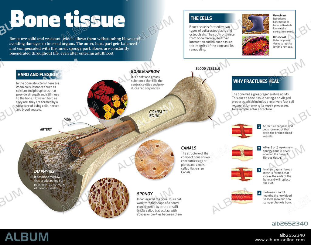 tejido óseo. Infografía del tejido óseo. Estructura del hueso y detalle del por qué se curan las fracturas.