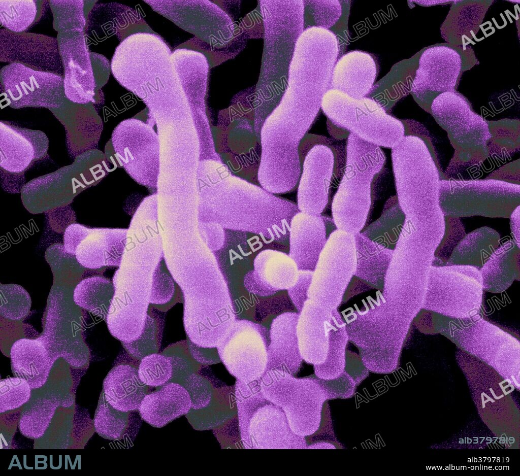 colour enhanced scanning electron micrograph (SEM) of Bifidobacterium pullorum. Bifidobacteria are probiotic bacteria, useful for human and animal health by providing protection from pathogenic bacteria. (fr. 801193, mag. 13,000x), image width W: 7.3 um.