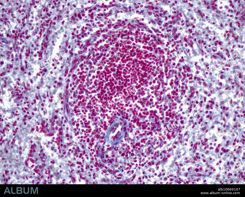 Spleen, human, Mallory Azan stain, 200X. Light micrograph.