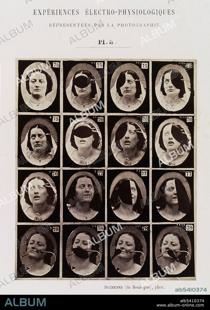 Duchenne, Mechanism of Human Physiognomy, 1862
