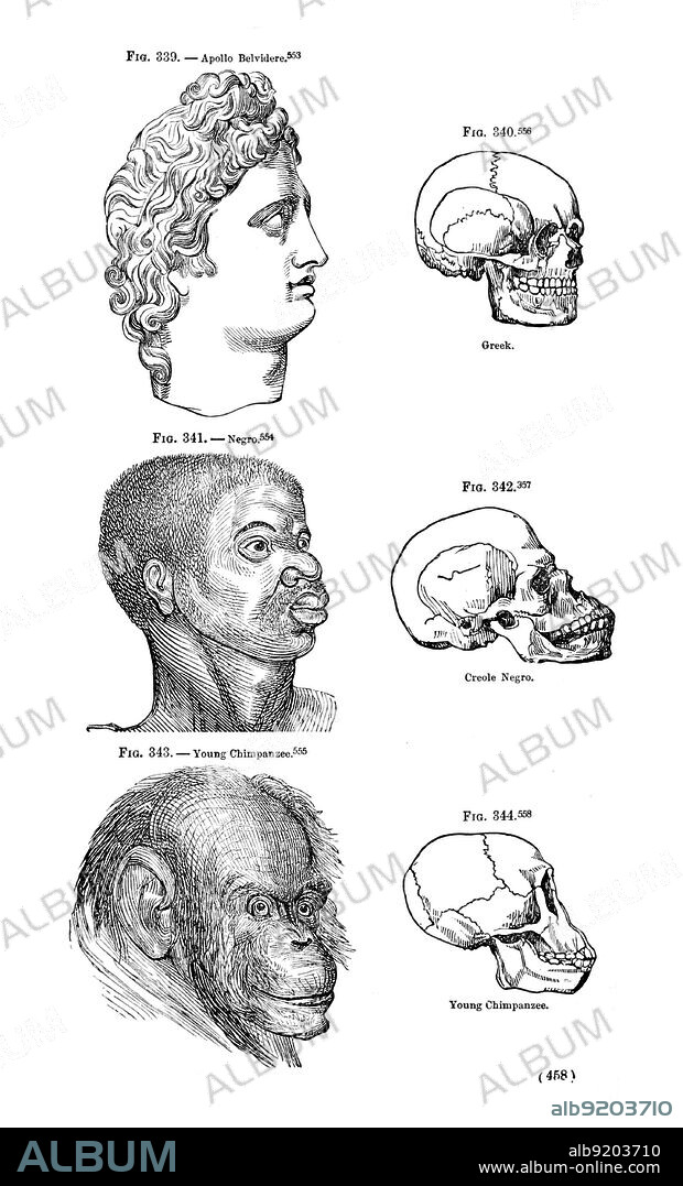 Illustration from Indigenous Races of the Earth (1857), whose authors Josiah Clark Nott and George Robins Gliddon implied that Negroes were a creational rank between Greeks and chimpanzees. Polygenism is a theory of human origins which posits the view that the human races are of different origins (polygenesis). This view is opposite to the idea of monogenism, which posits a single origin of humanity. Modern scientific views no longer favor the polygenic model.