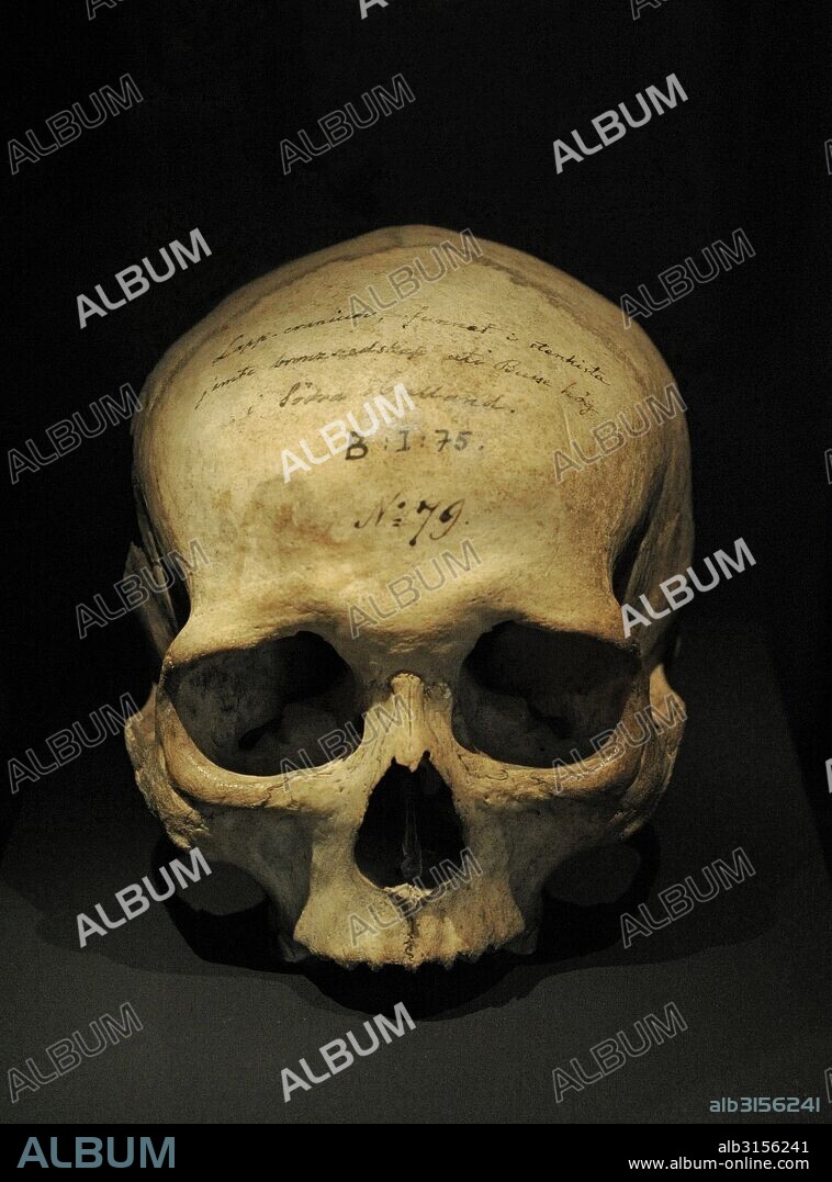 Cráneo humano hallado en un montículo funerario. 1700-500 a. C. Hasslov, región de Halland. Museo Histórico. Estocolmo. Suecia.
