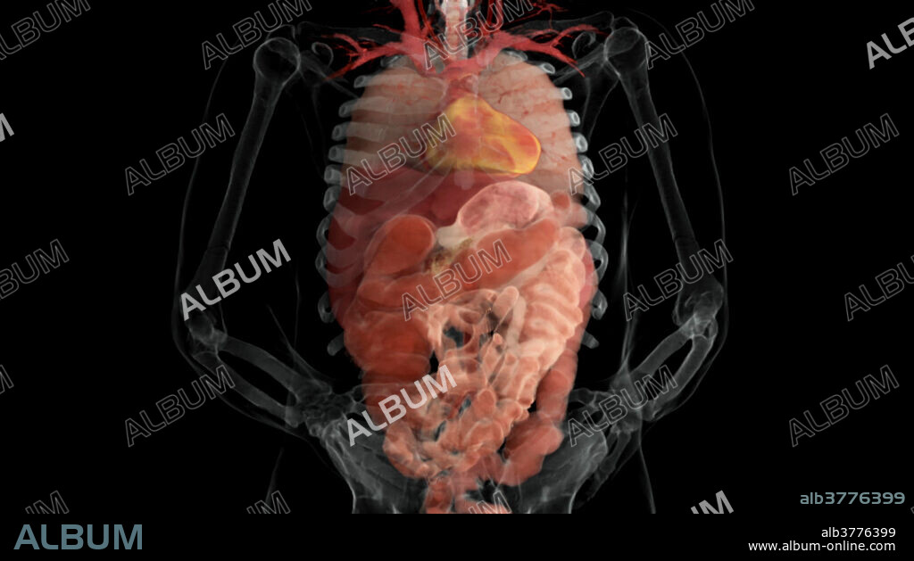 3-D visualization using scanned human data of showing an anterior view of the pulmonary circulatory system as well as various organs contained in the thorax and abdomen. The heart, lungs, liver, stomach, colon and small intestine are visible.