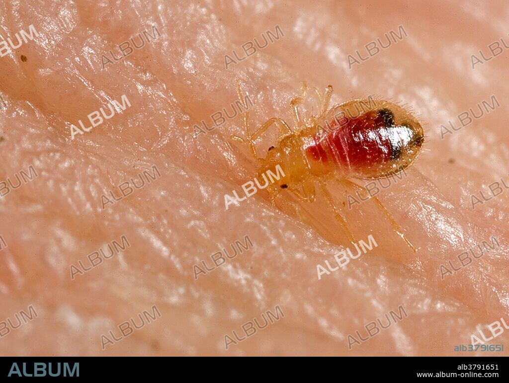 Bed bug nymph, Cimex lectularius in the process of ingesting a blood meal (seen filling the insect's abdomen) from the arm of a human host. Bed bugs are not vectors in nature of any known human disease. The common bed bug is found worldwide. Infestations are common in the developing world, occurring in settings of unsanitary living conditions and severe crowding. In North America and Western Europe, bed bug infestations became rare during the second half of the 20th century and have been viewed as a condition that occurs in travelers returning from developing countries. However, anecdotal reports suggest that bed bugs are increasingly common in the United States, Canada, and the United Kingdom. The common bed bug C. lectularius is a wingless, red-brown, blood-sucking insect that grows up to 7 mm in length and has a lifespan from 4 months up to 1 year. Bed bugs hide in cracks and crevices in beds, wooden furniture, floors, and walls during the daytime and emerge at night to feed on their preferred host, humans.