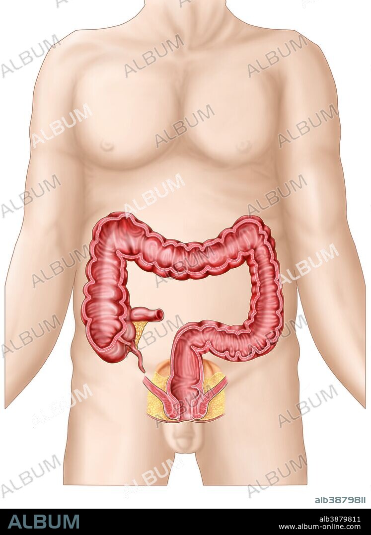 Sectional view of large intestine.