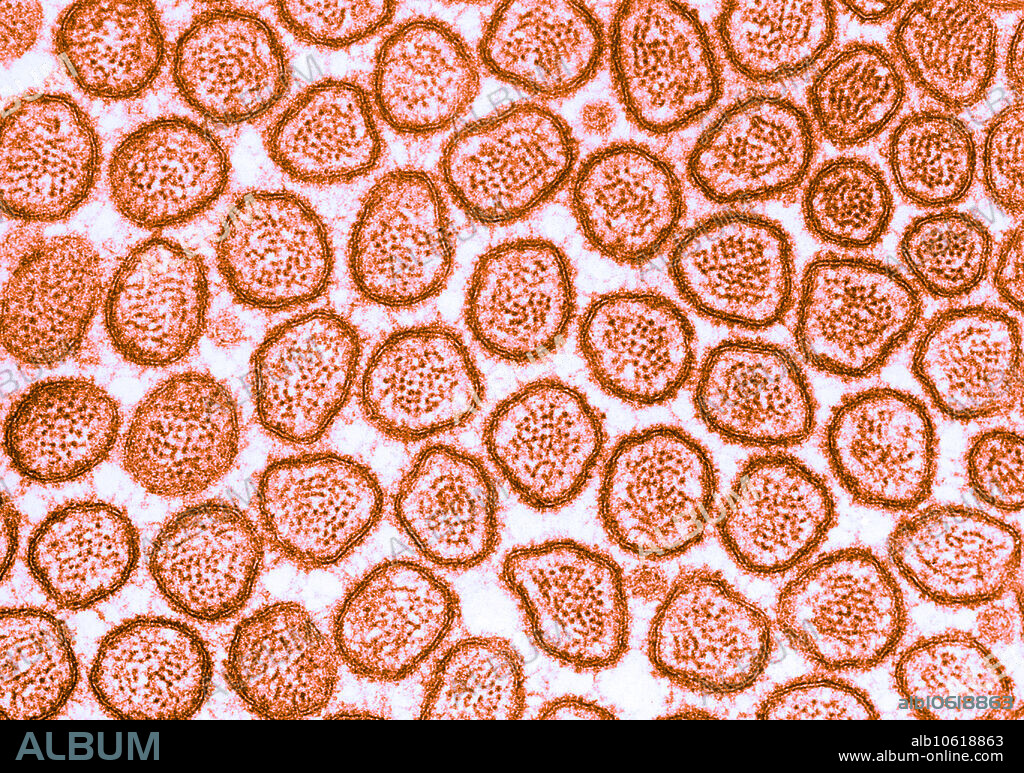 Colour enhanced transmission electron micrograph of microvilli of the brush border of cat intestinal epithelium. This transverse section of intestinal brush border shows the actin filaments that form the core of each microvillus. At the villus tip, the relation of the filaments to the membrane is obscured by a layer of dense amorphous material associated with the inner aspect of the membrane.