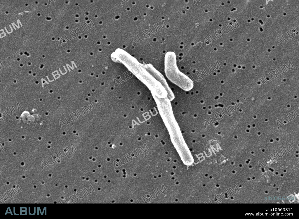 Scanning Electron Micrograph (SEM) image depicted a number of Gram-positive Mycobacterium tuberculosis bacteria. As an obligate aerobic organism M. tuberculosis can only survive in an environment containing oxygen. The bacteria are put into the air when a person with active TB disease of the lungs or throat coughs or sneezes. People nearby may breathe in these bacteria and become infected. When a person breathes in TB bacteria, the bacteria can settle in the lungs and begin to grow. From there, they can move through the blood to other parts of the body, such as the kidney, spine, and brain. TB in the lungs or throat can be infectious. This means that the bacteria can be spread to other people. TB in other parts of the body, such as the kidney or spine, is usually not infectious. People with active TB disease are most likely to spread it to people they spend time with every day. This includes family members, friends, and coworkers. Magnification: 13172x.