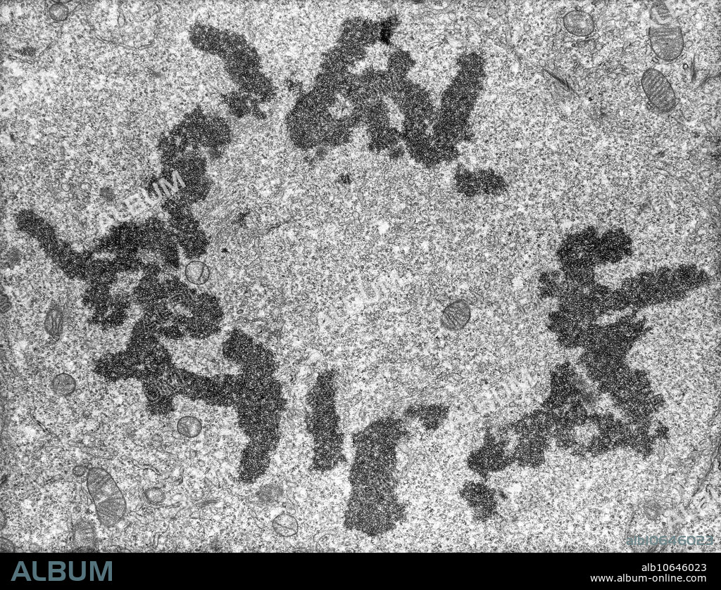 Transmission electron micrograph of cross section showing mitosis, metaphase plate. No magnification given. Mitosis, the usual method of cell division, characterized typically by the resolving of the chromatin of the nucleus into a threadlike form, which condenses into chromosomes, each of which separates longitudinally into two parts, one part of each chromosome being retained in each of two new cells resulting from the original cell. The four main phases of mitosis are prophase, metaphase, anaphase, and telophase.