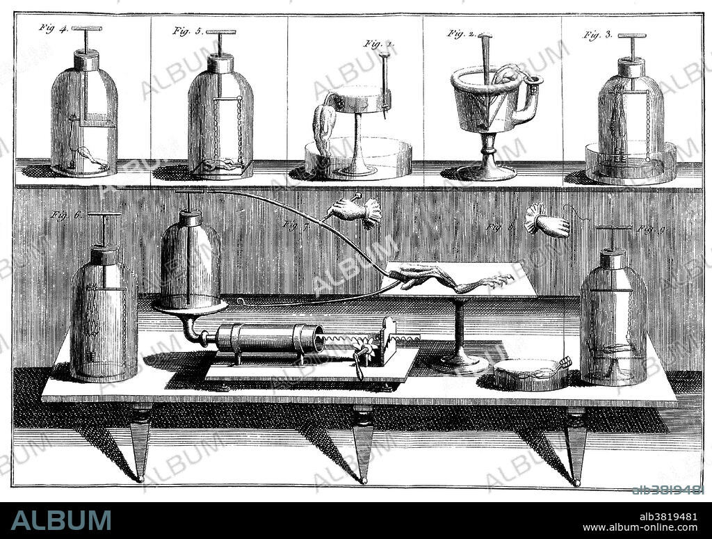 Galvanism experiments. Galvanism is the contraction of a muscle that is stimulated by an electric current. The effect was named after Luigi Galvani (September 9, 1737 - December 4, 1798), who investigated the effect of electricity on dissected animals in the 1780-90s. Giovanni Aldini (April 10, 1762 - January 17, 1834) was an Italian physicist and nephew of Galvani. His most famous public demonstration of the electro-stimulation technique of deceased limbs was performed on the executed criminal George Forster in London, 1803. The Newgate Calendar describes what happened: "On the first application of the process to the face, the jaws of the deceased criminal began to quiver, and the adjoining muscles were horribly contorted, and one eye was actually opened." Image appeared in "Essai theoretique experimental sur le Galvanisme" by Giovanni Aldini, 1804.