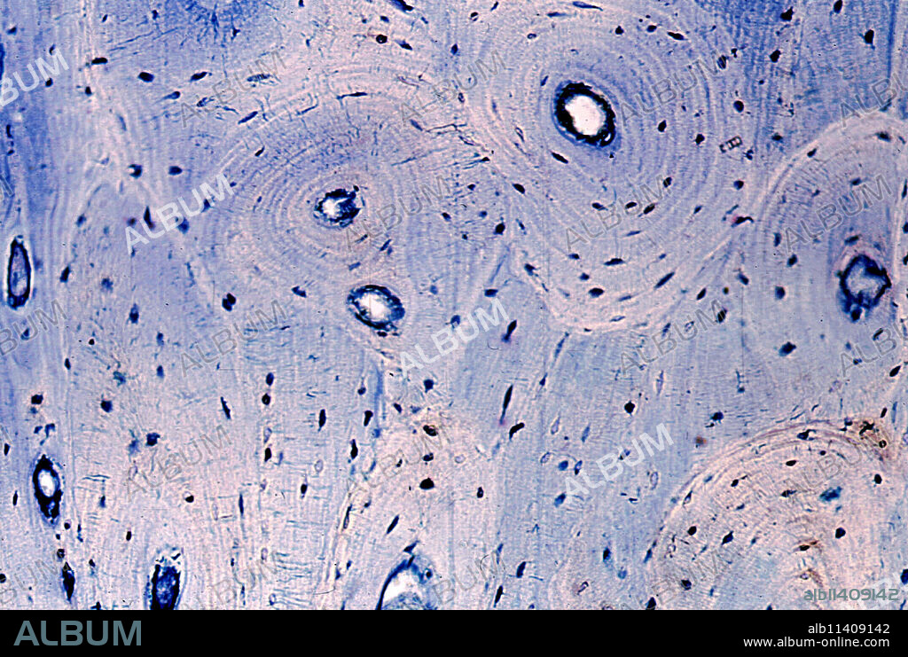 Light micrograph of compact bone. Osteons are rounded or oval structures, made up of bony lamellae arranged concentrically around a small duct called (Haversian duct). Between the lamellae are the oval bodies of the osteocytes. Among the osteons there are groupings of bone lamellae called interstitial lamellae, which are the remnants of osteons that were partially resorbed during the process of bone remodeling.