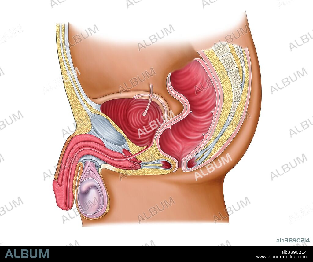 Medical illustration of a rectourethral fistula.