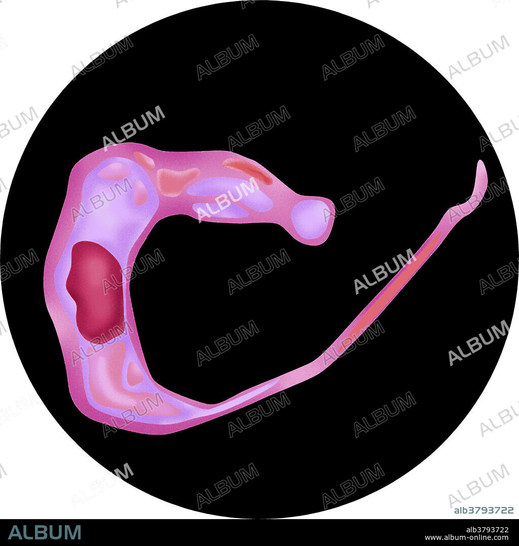 Illustration of metacyclic trypomastigote. Trypanosomes are protozoan parasites that cause American trypanosomiasis, or Chagas disease. The disease is spread by the Chagas beetle. The identical-looking trypomastigotes of T. cruzi are found in the blood of people with sleeping sickness (African trypanosomiasis).