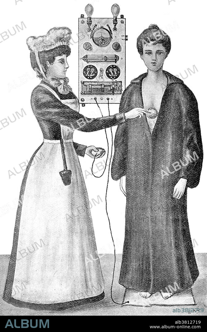 The third stage of General Faradization. Nurse applying electrical current, faradic current, to patient via an electrical vibrator, or bipolar electrodes of Apostoli. Faradizing is used to stimulate or treat (muscles or nerves) with induced alternating electric current. Electrotherapy is the use of electrical energy as a medical treatment. In medicine, the term electrotherapy can apply to a variety of treatments, including the use of electrical devices such as deep brain stimulators for neurological disease. The term has also been applied specifically to the use of electric current to speed wound healing. The first medical treatments with electricity in London have been recorded as far back as 1767 at Middlesex Hospital in London using a special apparatus. The same was purchased for St. Bartholomew's Hospital only ten years later. The record of uses other than being therapeutic is not clear, however Guy's Hospital has a published list of cases from the earlier 1800s.