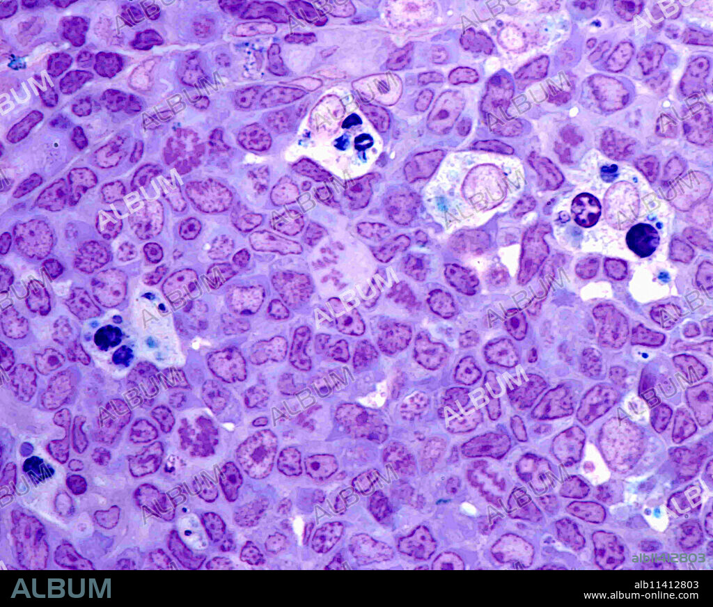 Germinal center of a lymphoid secondary follicle showing large clear macrophages with phagocyted cell debris and several centroblasts in mitosis. 0.5 micrometre thick section of plastic embedded material stained with toluidine blue.