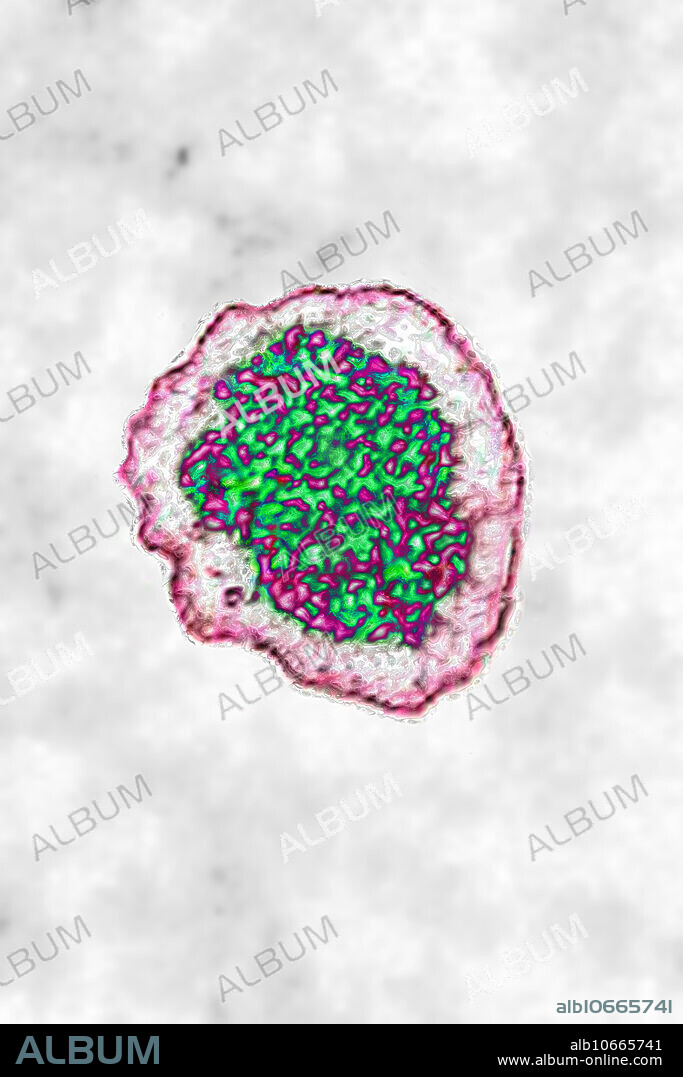 Nipah virus, TEM