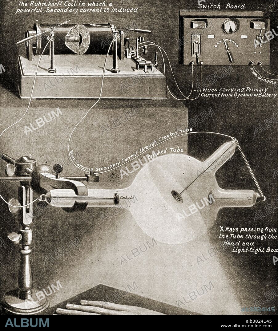 Crookes tube. A diagram showing the apparatus being used to X-ray a hand, 1912. Wilhelm Rontgen discovered X-rays using the Crookes tube in 1895. The Crookes tube was a forerunner to the modern cathode ray tube and television. Crookes tubes were used by British physicist Sir William Crookes from 1878 to investigate cathode rays. He found that the rays, which are actually beams of electrons, made glass fluoresce. Crookes also found that the cathode rays could be bent by applying a magnetic field. The discovery that cathode rays were charged led directly to J.J. Thompson's discovery of the electron in 1897.