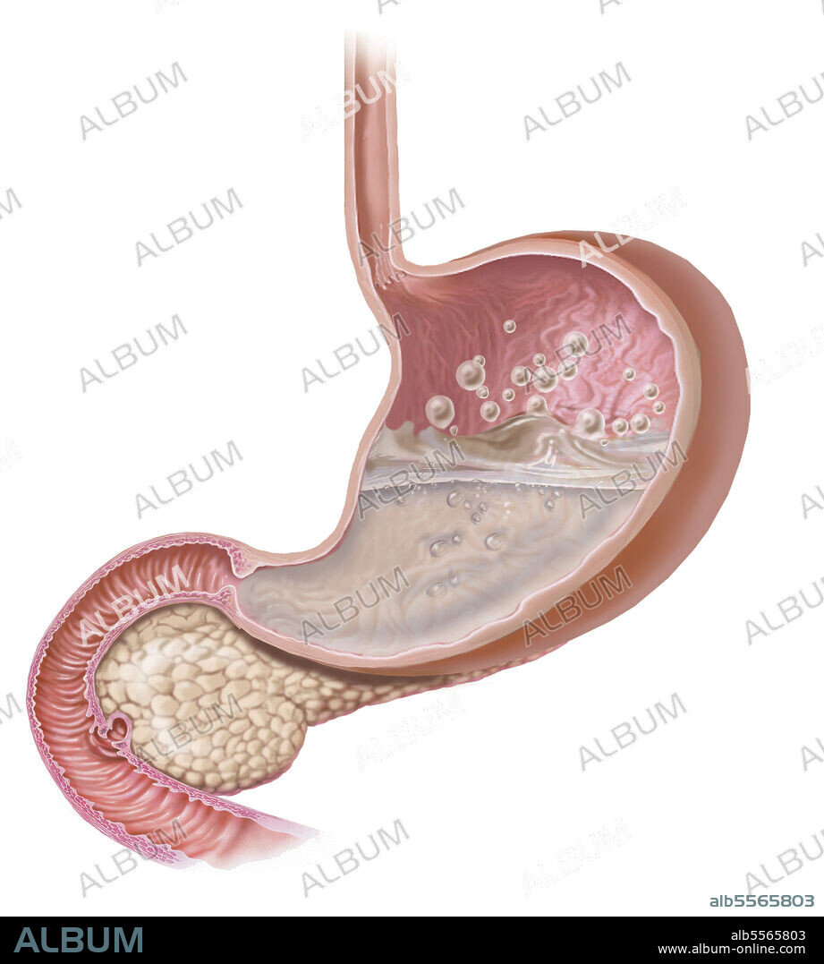 Stomach with excessive gas and bubbles. - Album alb5565803