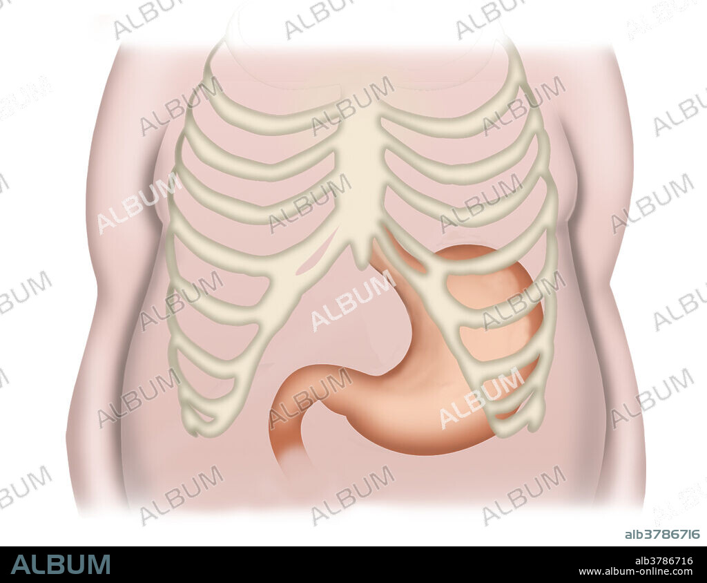 Medical illustration of an obese human torso, including the ribs and orientation location of the stomach.