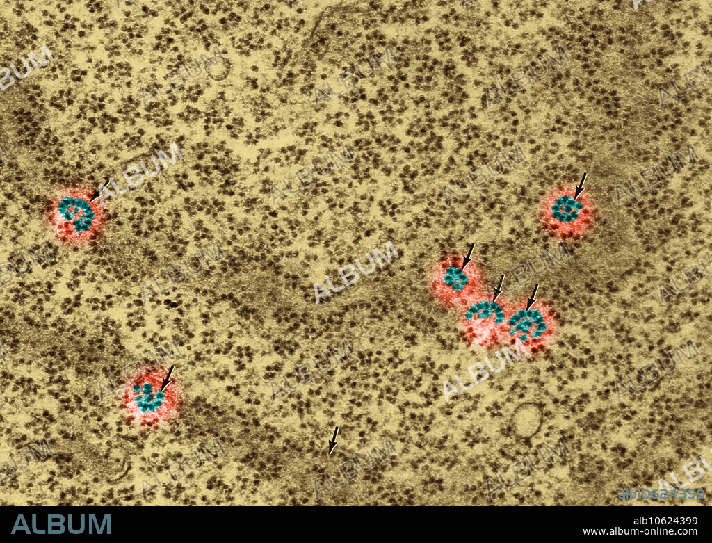 Colour-enhanced Transmission Electron Micrograph (TEM) of a section of a Nissl body showing free polysomes. A Nissl body is a large angular block of basophilic material, seen in neurons, composed of orderly arrays of cisternae of the endoplasmic reticulum. Nissl bodies are a site of protein synthesis.