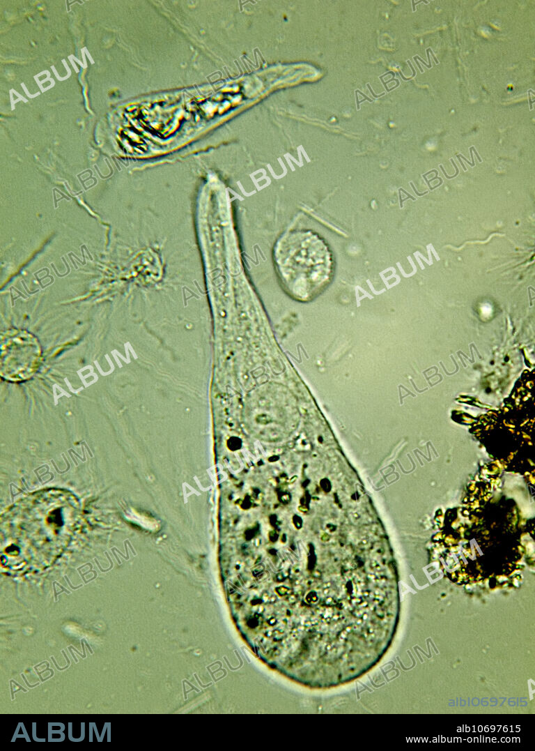 Light micrograph of protozoa of the genus Oxymonas. These protozoa lives as symbiotic organisms in the gut of termites of the genus Reticulitermes. Wood particles are seen inside the cell.