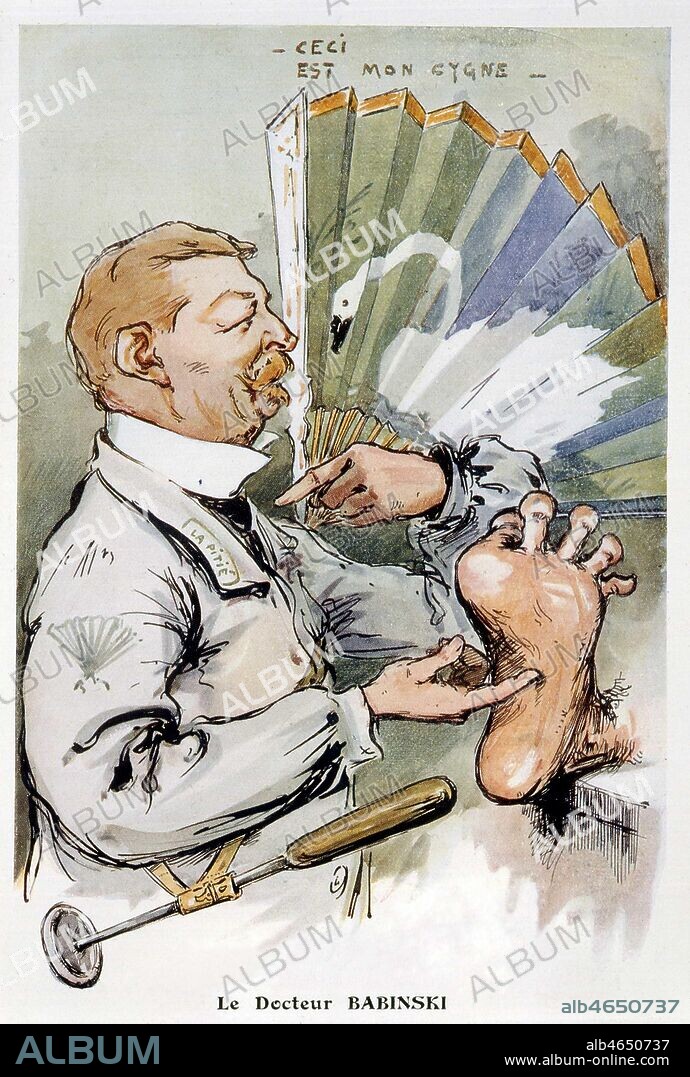 'Le docteur Joseph BABINSKI (1857-1932) chatouille la plante du pied d'un patient pour provoquer le reflexe qu'il a mis en valeur ; le 'signe de Babinski' ou 'signe de l'eventail'. Portrait-charge par Georges VILLA (1883-1965) pour Chanteclair en 1911. ADAGP. Credit Collection Jonas/Kharbine-Tapabor.