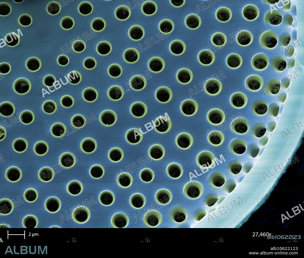 SEM of a saltwater diatom. Diatoms are single-celled photosynthetic algae. They have mineralized cell walls that contain silica and provide protection and support. The diatoms form an important part of the plankton at the base of the marine and freshwater food chains. Magnification: 27,460x and the calibration bar is 2 um.