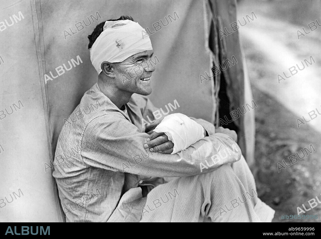 Injured American Soldier, American Military Hospital No. 5, supported by American Red Cross, Auteuil, France, Lewis Wickes Hine, American National Red Cross Photograph Collection, June 1918.