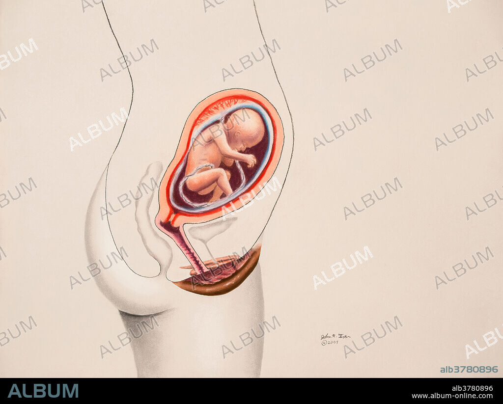 Foetus in womb at the end of the fifth month. Foetus is now about eight to ten inches long and weighs ten to twelve ounces. Movements are more apparent. Lanugo and vernix form to protect the skin. Hair may start to grow on head. Image 5 of 9.