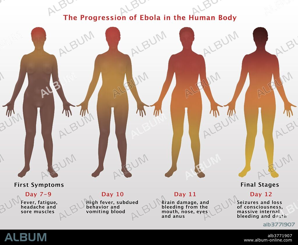 Progression of Ebola, Illustration