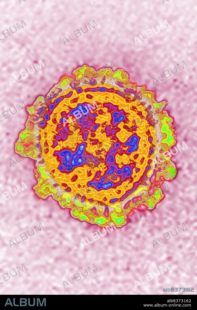 Influenza virus (from the Orthomyxoviridae family and the Influenzavirus genus). Image made from a transmission electron microscopy view.