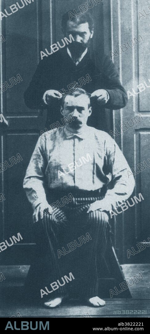 The system recorded 12 measurements including the circumference of the skull. Alphonse Bertillon (1853-1914) was a French police officer and biometrics researcher who created anthropometry, an identification system based on physical measurements. Anthropometry was the first scientific system used by police to identify criminals. Before that time, criminals could only be identified based on unreliable eyewitness accounts. The method was eventually supplanted by fingerprinting, but his other contributions like the mug shot and the systematization of crime-scene photography remain in place to this day.