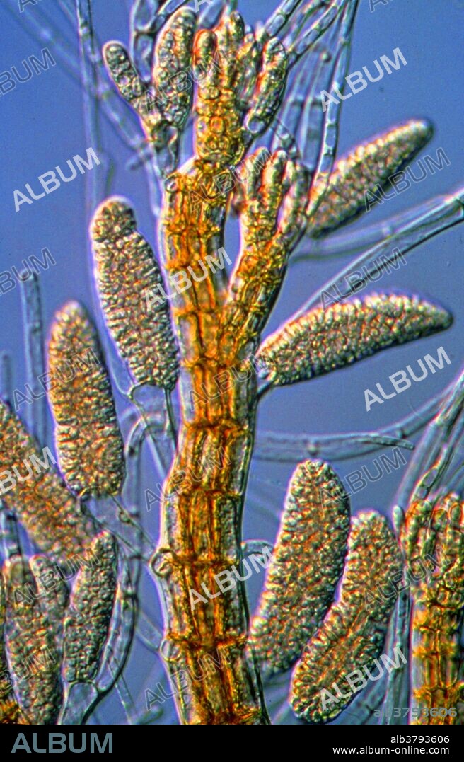 Marine red alga from the genus Polysiphonia; male plant with antheridia, (producing male gametes); part of the sexual life cycle of this member of Rhodophyceae.