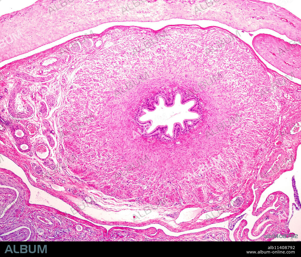The vas deferens (ductus deferens) is a duct located in the spermatic cord, connecting epididymis with ejaculatory duct in the urethra. Cross-sectioned vas deferens showing a thick muscular layer surrounding the internal mucosal layer.